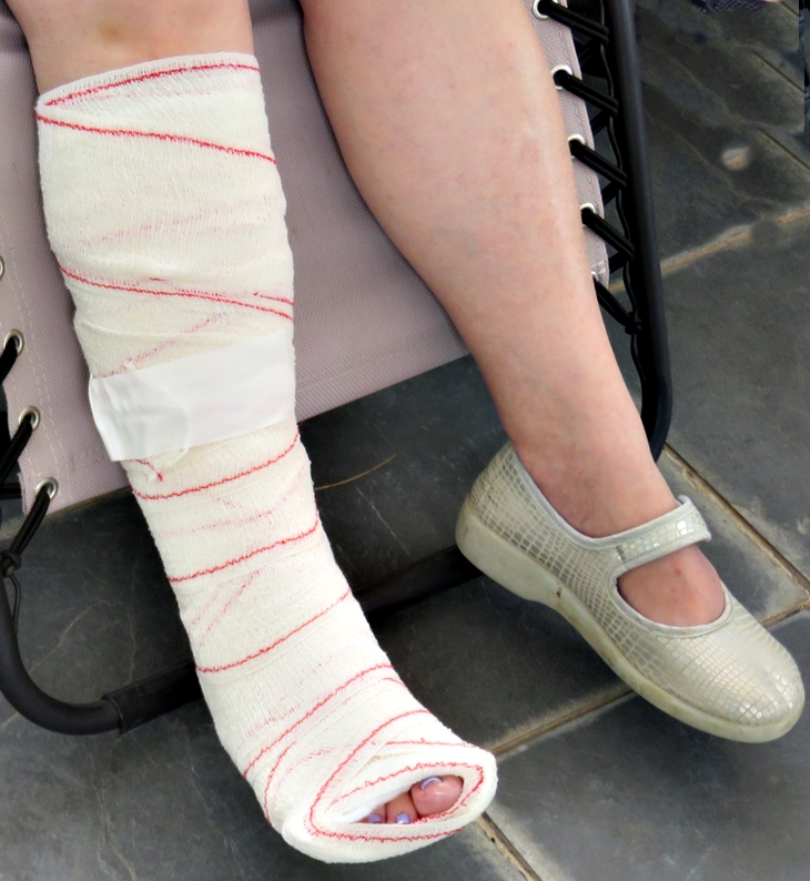 Venda sobre escayola&nbsp;(2021)